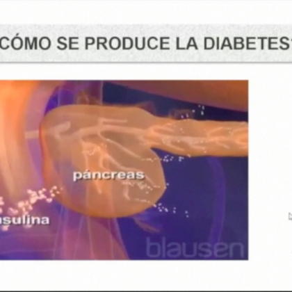 Educación en Diabetes