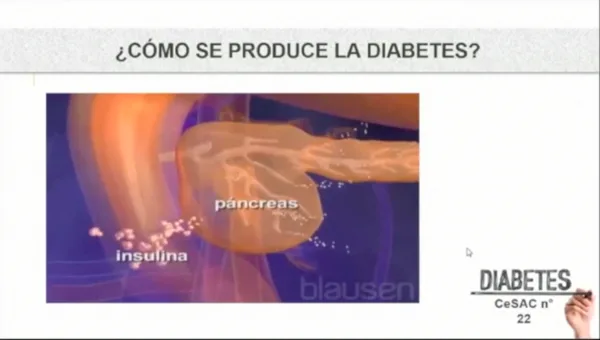 Educación en Diabetes